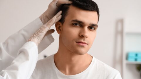 Reasons to Consider a Hair Tran